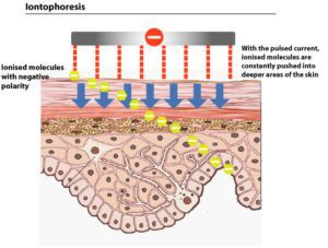 iontophoresis